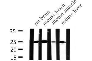 Western blot analysis of APOA1 expression in various lysates (APOA1 antibody  (N-Term))