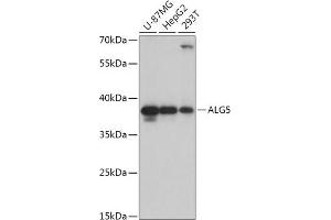 Western blot analysis of extracts of various cell lines, using  antibody (ABIN7265696) at 1:1000 dilution. (ALG5 antibody  (AA 34-190))