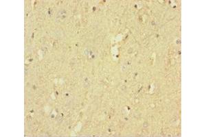 Immunohistochemistry of paraffin-embedded human brain tissue using ABIN7167522 at dilution of 1:100 (PTPRZ1 antibody  (AA 36-300))