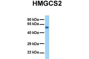 Host:  Rabbit  Target Name:  HMGCS2  Sample Tissue:  Human Fetal Liver  Antibody Dilution:  1. (HMGCS2 antibody  (N-Term))