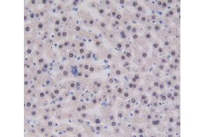 IHC-P analysis of liver tissue, with DAB staining. (CUBN antibody  (AA 3511-3623))