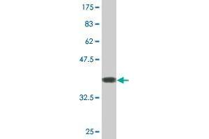 Western Blot detection against Immunogen (36. (ALS2 antibody  (AA 221-320))