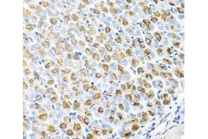 Immunohistochemistry of paraffin-embedded Mouse stomach using FECH Polyclonal Antibody at dilution of 1:100 (40x lens). (FECH antibody)