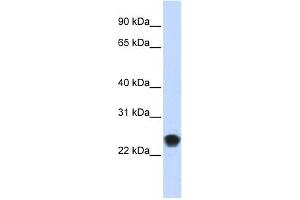 FKBP11 antibody used at 1 ug/ml to detect target protein. (FKBP11 antibody  (N-Term))