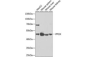 Western blot analysis of extracts of various cell lines, using PPOX Antibody (ABIN6129092, ABIN6146051, ABIN6146052 and ABIN6222026) at 1:1000 dilution. (PPOX antibody  (AA 1-280))