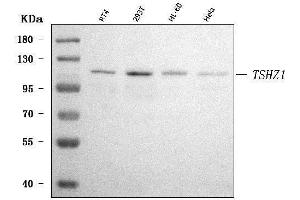 Western blot analysis of TSHZ1 using anti-TSHZ1 antibody (ABIN7602710).