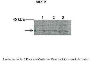 Lanes:   1. (SIRT2 antibody  (C-Term))