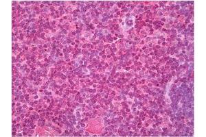Thymus stained with Cellubrevin antibody in Immunohistochemistry on Paraffin Sections. (VAMP3 antibody  (N-Term))