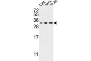Western Blotting (WB) image for anti-Tetraspanin 2 (TSPAN2) antibody (ABIN3004129)