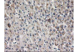 Immunohistochemical staining of paraffin-embedded Human liver tissue using anti-PGAM2 mouse monoclonal antibody. (PGAM2 antibody)