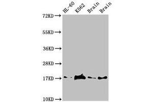 Western Blot Positive WB detected in: HL60 whole cell lysate, K562 whole cell lyaste, Mouse brain tissue, Rat brain tissue All lanes: UBE2V2 antibody at 1. (UBE2V2 antibody  (AA 2-145))