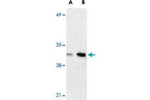 Western blot analysis of ANP32A expression in human Raji cell lysate with ANP32A polyclonal antibody  at 2 ug/mL (lane A) and 4 ug/mL (lane B), respectively.