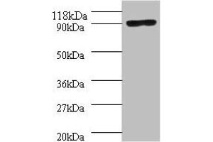 Western blot All lanes: Aquaticus DNA polymerase I, thermostable antibody at 2 μg/mL + 293T whole cell lysate Secondary Goat polyclonal to rabbit IgG at 1/10000 dilution Predicted band size: 94 kDa Observed band size: 94 kDa (POLA1 antibody  (AA 310-832))