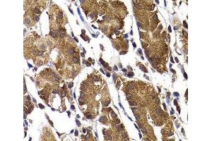 Immunohistochemistry of paraffin-embedded Human stomach using STAMBP Polyclonal Antibody at dilution of 1:100 (40x lens). (STAMBP antibody)