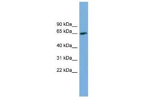 WB Suggested Anti-TBC1D24 Antibody Titration: 0. (TBC1D24 antibody  (Middle Region))