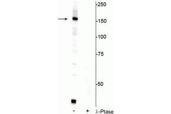 FANCI anticorps  (pSer556)