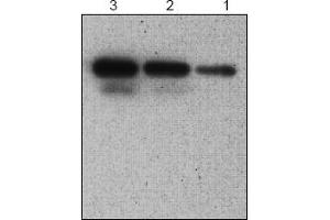Western Blotting (WB) image for anti-serpin Peptidase Inhibitor, Clade B (Ovalbumin), Member 9 (SERPINB9) antibody (ABIN126942)