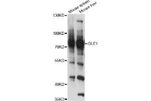 Western blot analysis of extracts of various cell lines, using GLE1 antibody (ABIN6293108) at 1:3000 dilution. (GLE1 antibody)