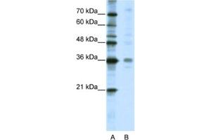 Western Blotting (WB) image for anti-Mediator Complex Subunit 27 (MED27) antibody (ABIN2461720)