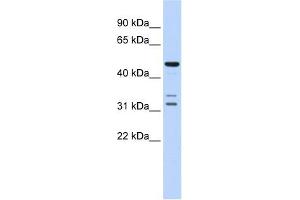 HTRA4 antibody used at 1 ug/ml to detect target protein. (HTRA4 antibody  (Middle Region))
