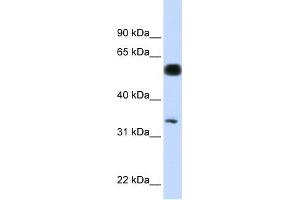 WB Suggested Anti-C19orf62 Antibody Titration: 0. (BRISC and BRCA1 A Complex Member 1 (BABAM1) (N-Term) antibody)