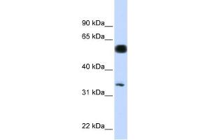 WB Suggested Anti-C19orf62 Antibody Titration: 0. (BRISC and BRCA1 A Complex Member 1 (BABAM1) (N-Term) antibody)