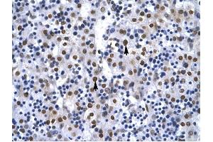 G22P1 antibody was used for immunohistochemistry at a concentration of 4-8 ug/ml to stain Hepatocytes arrows) in Human Liver. (XRCC6 antibody  (N-Term))