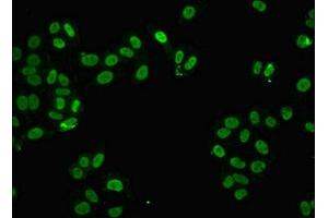 Immunofluorescent analysis of HepG2 cells using ABIN7168366 at dilution of 1:100 and Alexa Fluor 488-congugated AffiniPure Goat Anti-Rabbit IgG(H+L) (FUS antibody  (AA 1-198))