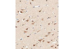 Immunohistochemical analysis of paraffin-embedded human brain tissue using (ABIN655975 and ABIN2845360) performed on the Leica® BOND RXm. (AP1M1 antibody  (AA 199-227))