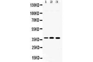 Western blot analysis of LDHA expression in rat spleen extract ( Lane 1), ANA-1 whole cell lysates ( Lane 2) and JURKAT whole cell lysates ( Lane 3). (Lactate Dehydrogenase A antibody  (AA 2-106))