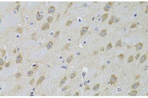 Immunohistochemistry of paraffin-embedded Mouse brain using ADRBK2 Polyclonal Antibody at dilution of 1:100 (40x lens). (ADRBK2 antibody)