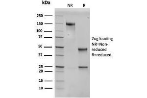 SDS-PAGE Analysis Purified PAI-RBP1 Mouse Monoclonal Antibody (SERBP1/3496). (SERBP1 antibody  (AA 3-139))