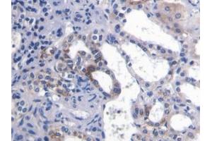 Immunohistochemistry (IHC) image for anti-Platelet/endothelial Cell Adhesion Molecule (PECAM1) (AA 78-214) antibody (ABIN7431653)