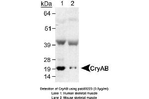 Image no. 1 for anti-Crystallin, alpha B (CRYAB) (AA 100-175), (Internal Region) antibody (ABIN363532)