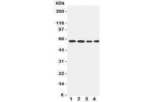 Western blot testing of LCAT antibody and Lane 1:  rat brain;  2: U87;  3: HeLa;  4: SMMC-7721 cell lysate. (LCAT antibody  (AA 300-313))
