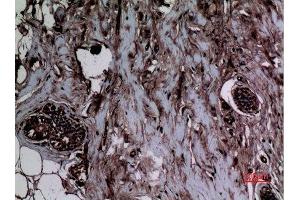 Immunohistochemistry (IHC) analysis of paraffin-embedded Human Breast, antibody was diluted at 1:100.