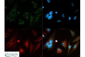 Image no. 5 for anti-Beclin 1, Autophagy Related (BECN1) antibody (ABIN363435) (Beclin 1 antibody)