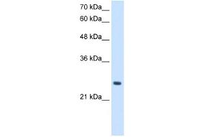 WB Suggested Anti-PPCDC Antibody Titration:  2. (PPCDC antibody  (N-Term))
