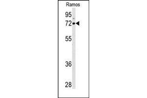 Image no. 1 for anti-Arachidonate 15-Lipoxygenase (ALOX15) (C-Term) antibody (ABIN360266) (ALOX15 antibody  (C-Term))