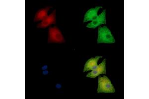 ABIN7095188 and ABIN7099244 staining  cells by IF/ICC. (CLIC5 antibody)