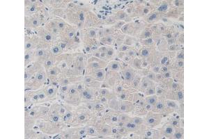 IHC-P analysis of Kidney tissue, with DAB staining. (GRK4 antibody  (AA 187-449))