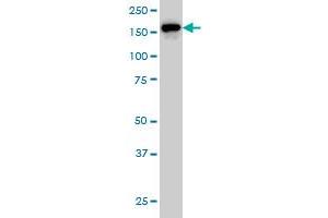 ROCK2 monoclonal antibody (M01), clone 2A4 Western Blot analysis of ROCK2 expression in HeLa . (ROCK2 antibody  (AA 1279-1388))