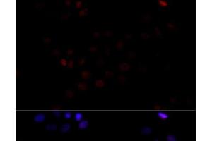 Immunofluorescence analysis of HeLa cells using TBP Polyclonal Antibody at dilution of 1:100 (40x lens). (TBP antibody)
