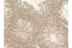 SCAI Mouse Monoclonal Antibody at 1/100 staining rat testis tissue by IHC-P.