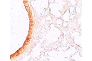 Immunohistochemical staining of mouse lung cells with SLC39A3 polyclonal antibody  at 5 ug/mL. (SLC39A3 antibody  (Internal Region))