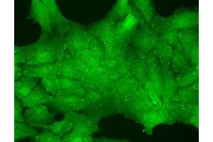 Immunocytochemistry/Immunofluorescence analysis using Mouse Anti-TrpC7 Monoclonal Antibody, Clone S64A-36 . (TRPC7 antibody  (AA 845-862) (Atto 594))