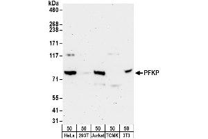 Western Blotting (WB) image for anti-phosphofructokinase, Platelet (PFKP) (AA 1-50) antibody (ABIN7450559)