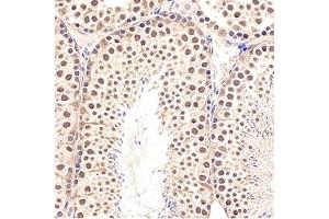 Immunohistochemistry analysis of paraffin-embedded mouse testis using,GTF2F2 (ABIN7074036)at dilution of 1: 3000 (GTF2F2 antibody)