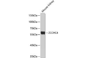 Western blot analysis of extracts of mouse kidney, using ZCCHC4 antibody (ABIN6133077, ABIN6150408, ABIN6150409 and ABIN6214292) at 1:1000 dilution. (ZCCHC4 antibody  (AA 50-220))
