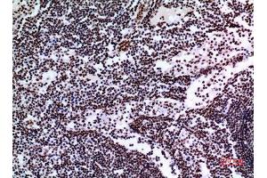Immunohistochemistry (IHC) analysis of paraffin-embedded Human Lymph Gland, antibody was diluted at 1:100. (Tumor Protein p73 antibody  (Tyr221))